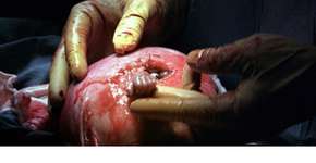 Foto: (Imagem sem texto alternativo disponivel ID [1436762])