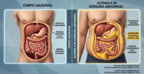 Gordura visceral: 3 estratégias baseadas na ciência para eliminar de vez