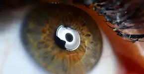 Foto: (Ivan-balvan/istock)