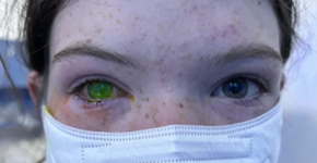 Foto: (reprodução/7news)