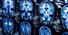 Afinal, existe relação entre uso do celular e câncer no cérebro? Veja o que a OMS diz sobre o assunto