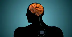 Paciente em depressão há 31 anos experimenta alegria intensa após tratamento experimental