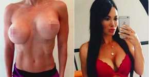 Foto: (Imagem sem texto alternativo disponivel ID [1415404])