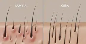 Foto: (Imagem sem texto alternativo disponivel ID [2705227])