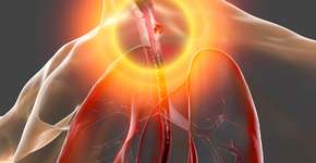 Essa dificuldade ao se alimentar pode ser sinal de câncer de esôfago