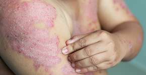 Foto: (Ranee Sornprasitt/istock)