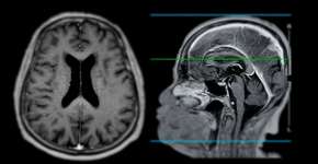 É isso que acontece com seu cérebro se você meditar todos os dias