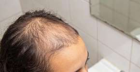 Foto: (Imagem sem texto alternativo disponivel ID [2701131])