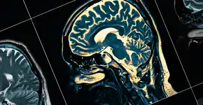 Foto: (sudok1/istock)