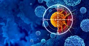 Estes são os sinais de alerta de câncer de mama metastático