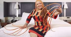 Foto: (Imagem sem texto alternativo disponivel ID [1489940])