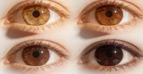 Foto: (Imagem sem texto alternativo disponivel ID [2701224])