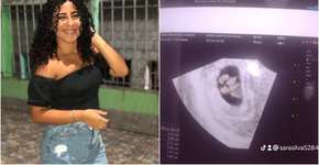 Vídeo de jovem descobrindo gravidez de quíntuplos viraliza; assista