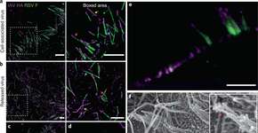 Foto: (divulgação/Nature Microbiology)