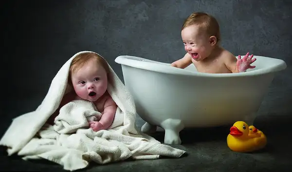 Bebês com síndrome de Down posam para calendário beneficente