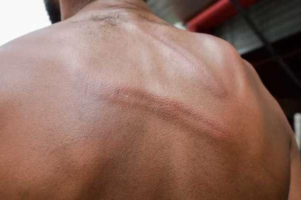 As agressões aos moradores da cracolândia são frequentes