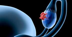 Foto: (Raycat/iStock)