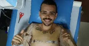 ‘Foi a melhor coisa da minha vida’, diz homem trans após mastectomia