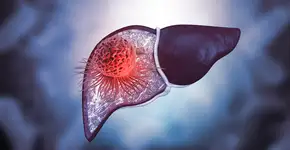 Pesquisadores conseguem inibir crescimento de tumor no fígado com extrato de nozes