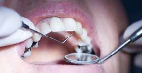 Foto: (garysludden/istock)