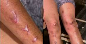 Foto: (Imagem sem texto alternativo disponivel ID [1114205])