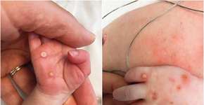 Foto: (reprodução/The New England Journal of Medecine)