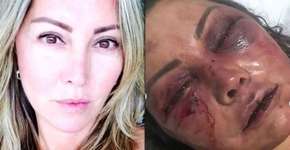 Mulher espancada depõe e pede que pessoas ajudem ao ouvir brigas