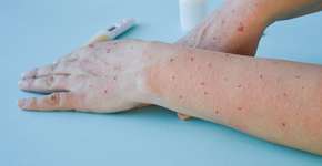 Foto: (Irina Starikova/istock)