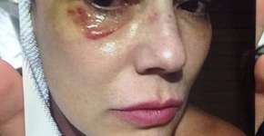 Após agressão, Luiza Brunet aciona Face por ofensas que recebeu