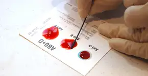 Foto: (wakila/istock)