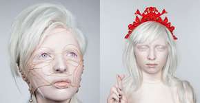 Foto: (Imagem sem texto alternativo disponivel ID [575886])