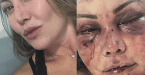 Paisagista posta fotos para mostrar recuperação após agressões