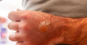 Foto: (Antonio Gravante/istock)