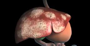 Foto: (Ozgu Arslan/istock)