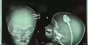 Foto: (Imagem sem texto alternativo disponivel ID [1164188])