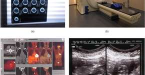 A evolução da imagem digital