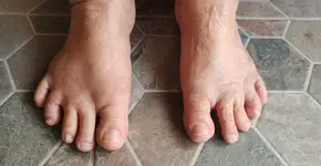 Foto: (iStock/Rungrudee)