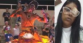 Mulher é agredida com facão e perde olho por intolerância religiosa