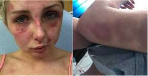 Jovem perde maço de cigarros do namorado e é torturada por ele