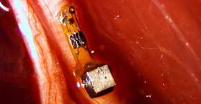 Foto: (Imagem sem texto alternativo disponivel ID [1894361])