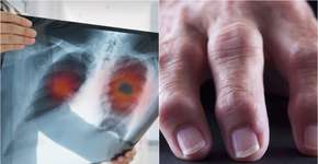 Foto: (utah778/rudisill/istock)