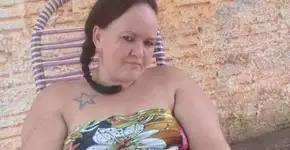 Vaquinha junta dinheiro à mulher que teve mãos decepadas pelo ex
