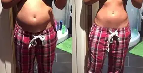 Blogueira mostra o que o estresse pode causar no corpo