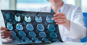 Medicamento para tratar Alzheimer precoce é aprovado; saiba tudo