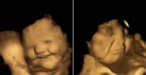 Ultrassom mostra fetos reagindo ao sabor dos alimentos ingeridos pela mãe