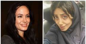 Mulher faz 50 plásticas para ficar igual Angelina Jolie