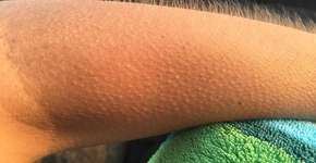 O que significa quando a pessoa tem um arrepio do nada?