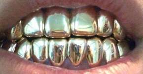 Com R$ 157 mil, Marco Feliciano teria todos seus dentes de ouro