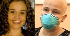 Boatos.org: Claudia Rodrigues perdeu cabelo após internação?