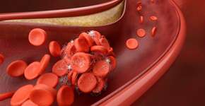 Dicas para controlar o colesterol alto